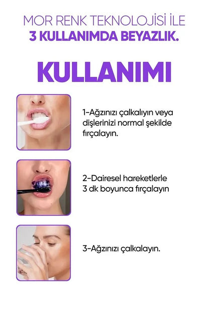 Diş Beyazlatıcı Jel
