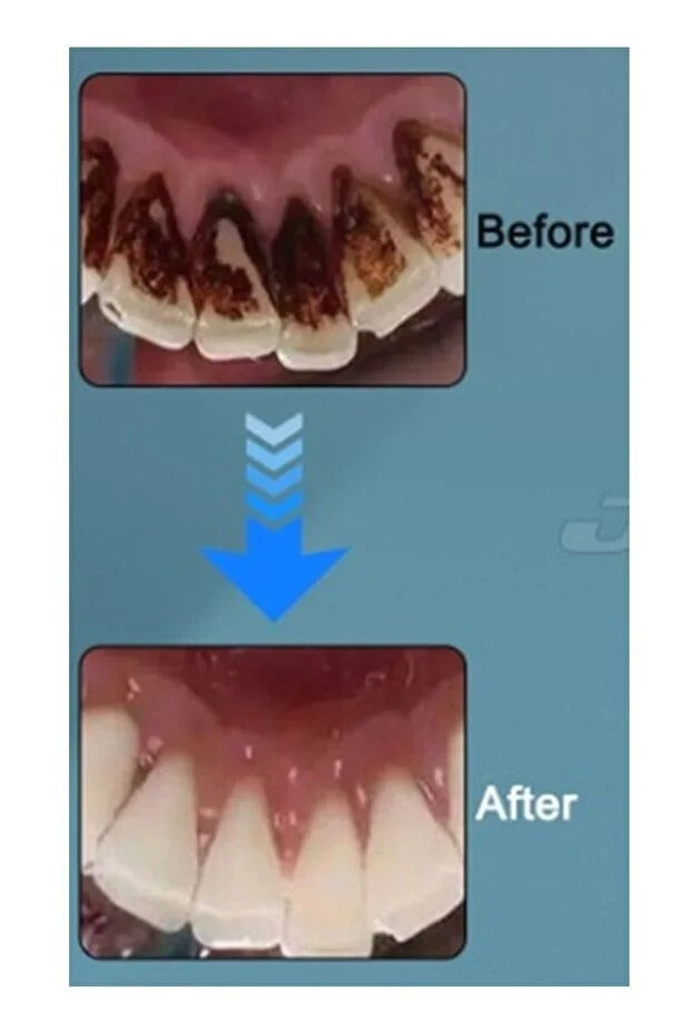Diş Silgisi Anında Beyazlık